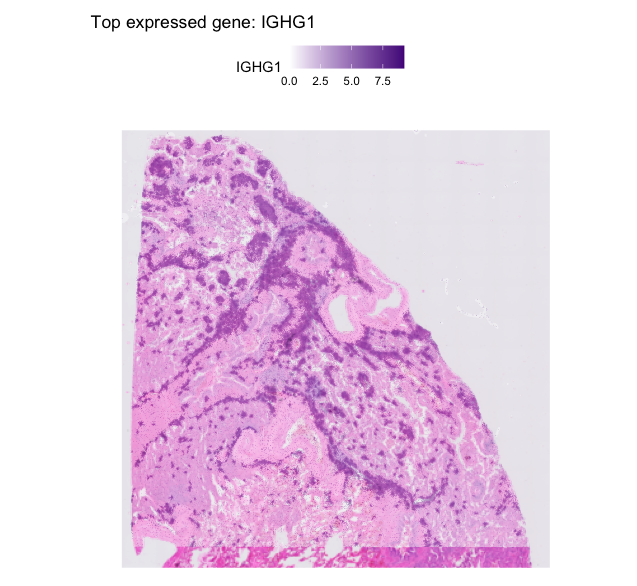**Figure 1. Visualization of Top Expressed Gene.** Example visualization of a highly expressed gene across spatial bins, displayed using **a single-color gradient** ranging from white to a saturated hue. This approach highlights spatial expression patterns while maintaining sensitivity to low-abundance signals.